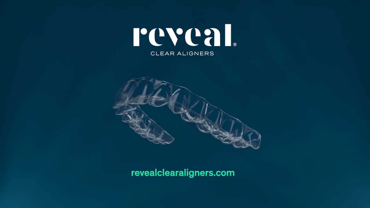 Reveal Clear Aligners